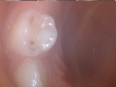 -极橙儿童齿科矫正中心(奥城店)