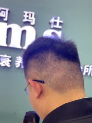 -阿玛仕