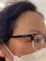 -海涛医疗美容·面部抗衰·注射美鼻