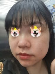 体验后-深圳医恒美医疗美容