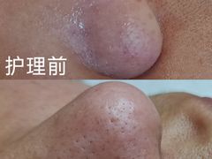 -中粮·祥云小镇