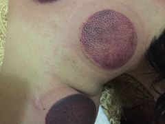 -御筋堂正骨推拿(星源国际店)