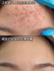 -春田皮肤管理中心品牌旗舰店