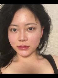 点击看大图 -上海伊莱美医疗美容医院