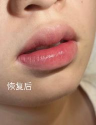 -西施无菌半永久纹绣眉眼影唇轻增发纹发际线