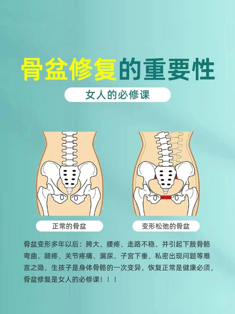 骨盆修复真人图片