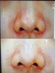 -苑苑vbeauty科技美容SPA