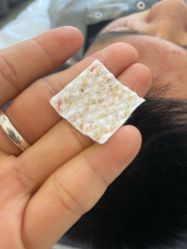 -瑶芳清颜草本祛痘