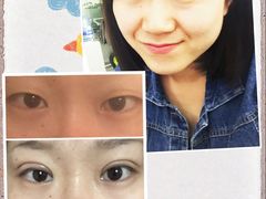 2DBB6DA6441CC9BCAFEB5E37CE141F1D-上海华安整形外科门诊部