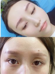 体验前-重庆联合丽格第五医疗美容医院