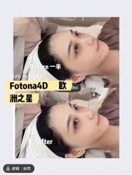 体验前-恒妍医美·韩国定制抗衰中心