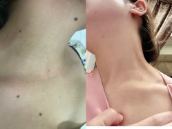 -智丽佳人祛斑祛痘美容美体