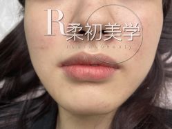 -RC半永久纹眉纹发际线