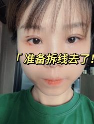 -八大处整形