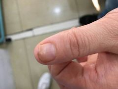 -世龙世家灰指甲·甲沟炎·跖疣护理·修脚(东江湾路店)
