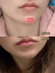 -美莱医学美容医院