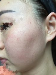 -皇族养心堂·净痘·修敏·御颜