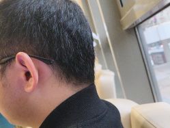 -碧莲盛·不剃发植发