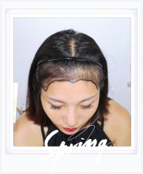 -大麦微针植发全国连锁