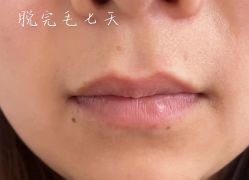 体验后-沈阳名流美容医院