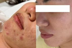 点击看大图 -SOS修丽可.痘肌修复中心