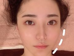 -FACE·日本小颜美容整骨(福田店)