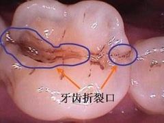 -团圆口腔·种植中心(锦江院区)