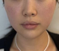 -Yestar 嘉兴艺星医疗美容医院