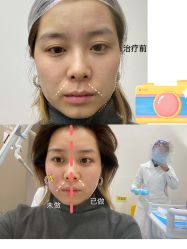 -上海时光整形外科医院