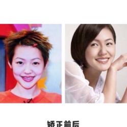 -Yestar宁波艺星整形医院