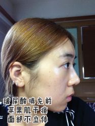 -厦门美莱整形美容医院