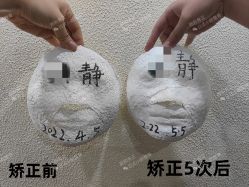 -颜和骨正·明哲式骨相美学整骨