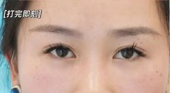 -天津健丽·去眼袋医疗美容机构