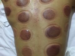 -益友堂盲人推拿正骨穴位按摩工作室