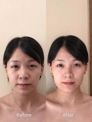 -SEAS小顏·日本小颜整骨美容サロン