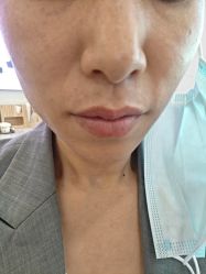 -长沙雅美医疗美容医院