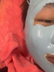 体验后-苗医生专业祛痘·皮肤管理