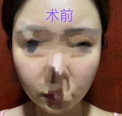 体验前-杭州医巢医疗美容