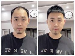 -发饰美男士增发补发假发定制店