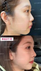 -北京米扬丽格医疗美容·联合丽格鼻整形中心