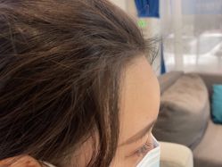 体验后-雍禾植发全国连锁