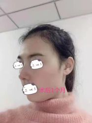 体验后-成都西区医院整形美容