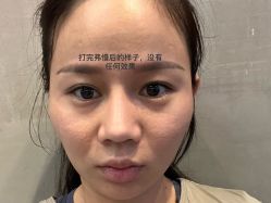 体验后-深圳医恒美医疗美容