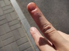 -首都医科大学附属北京潞河医院