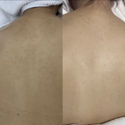 -彼家美创·量肤定制修护管理