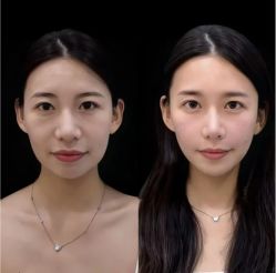 -上海伊莱美医疗美容医院