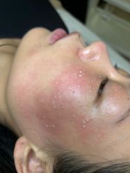 -清疣美疣·痣·斑净肤中心