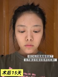 -Yestar重庆艺星医疗美容医院