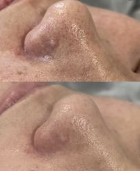 -SKIN79皮肤管理中心