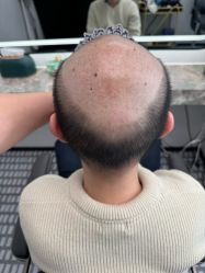 -唐风采假发补发定制